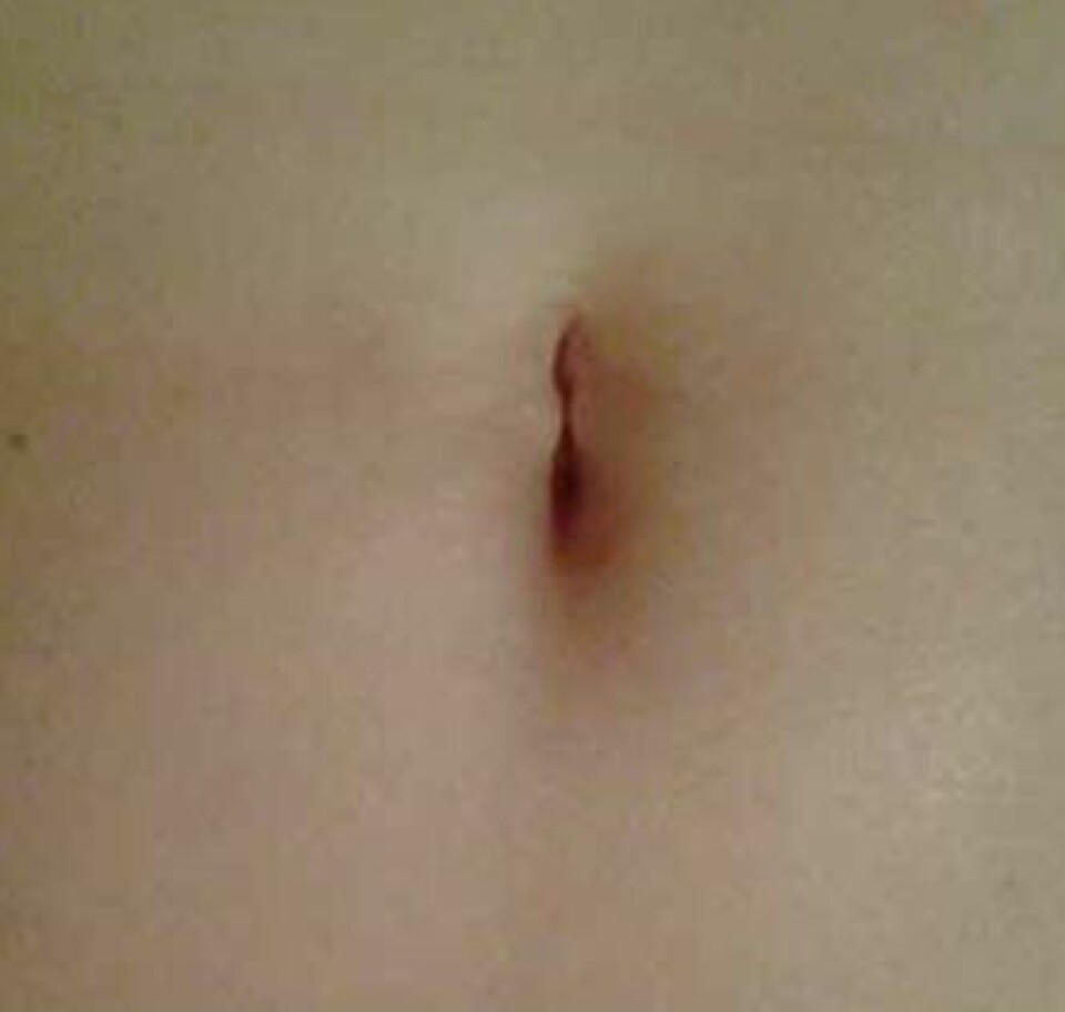 Systemet som sådan har liten nytte av god magefølelse, så derfor må man reflektere over den - slik at man kan gi den tause kunnskapen videre. Illustrasjonfoto: Courtney Morris