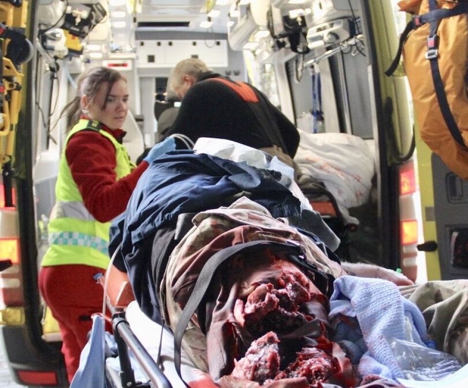 Fra nasjonal helseøvelse St. Olavs Hospital 2018. Amputasjonen er ikke ekte.