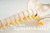QUIZ: Hvor mye kan du om spinalskader? Test deg selv!